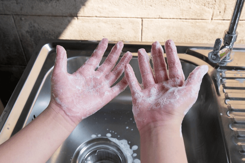 Nguyên nhân dị ứng là do tay phải tiếp xúc trực tiếp với các hóa chất mạnh có tính ăn mòn cao trong nước rửa chén Tay bị dị ứng nước rửa chén
